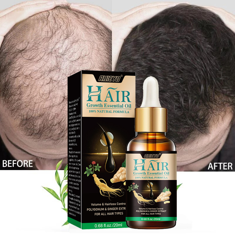 Epidermal Growth Factor - Aceite de biotina 2023 para el