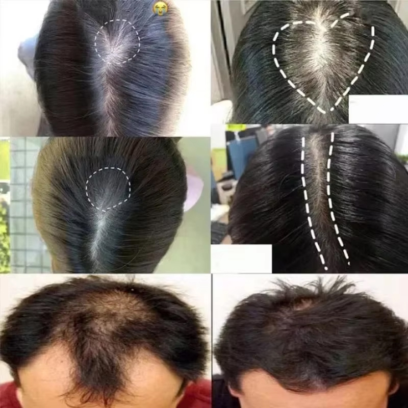 Suero para el crecimiento del  - Epidermal Growth Factor reseña y precio
