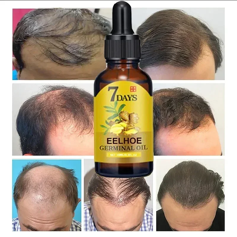 Aceite de crecimiento rápido d - Epidermal Growth Factor reseña y precio