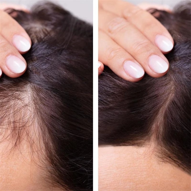 Aceite de biotina 2023 para el - Epidermal Growth Factor reseña y precio