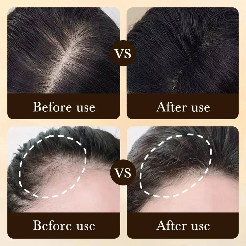 Aceite de Biotina para el Crec - Epidermal Growth Factor reseña y precio