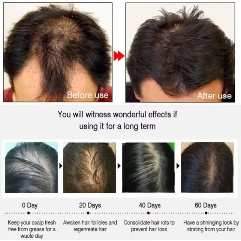 Suero para el crecimiento del  - Epidermal Growth Factor reseña y precio